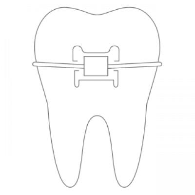 Grafik Bracket einer festen Zahnspange Kieferorthopädie Köln