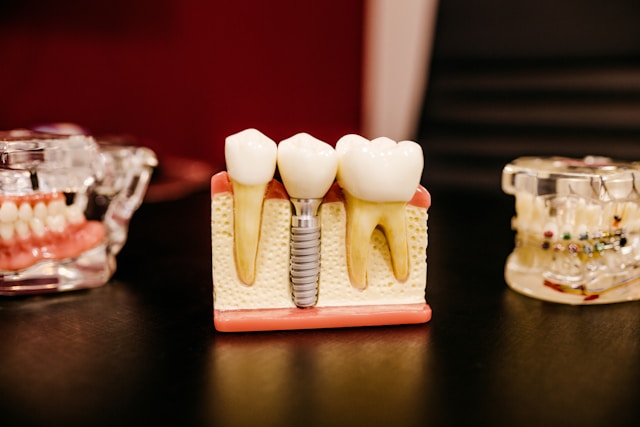 Präprothetische Kieferorthopädie – optimale Vorbereitung für Implantate, Kronen und Brücken